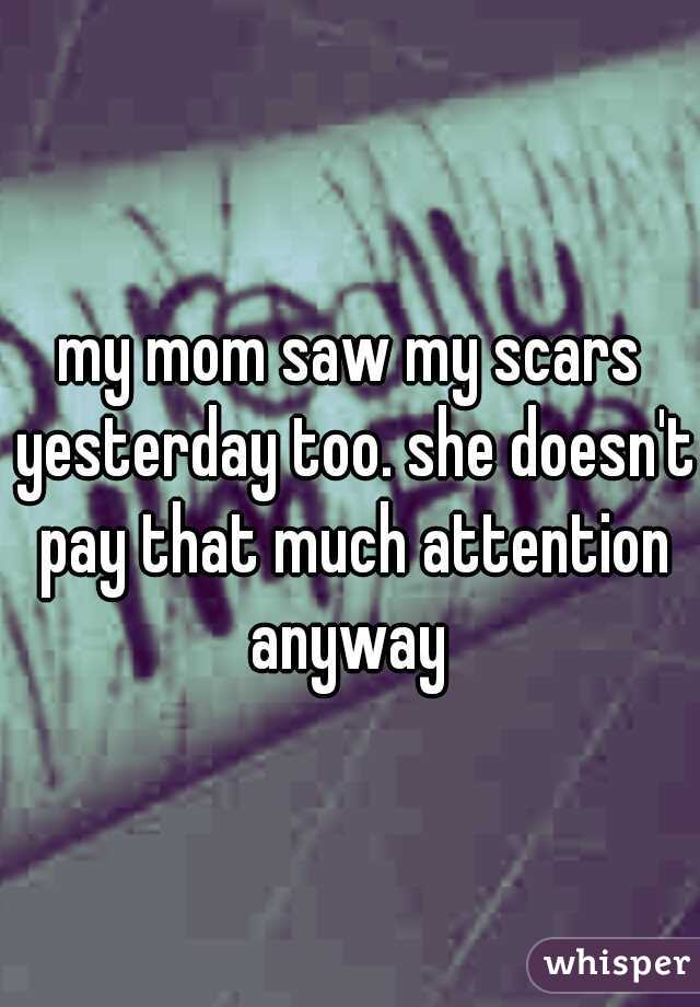 my mom saw my scars yesterday too. she doesn't pay that much attention anyway 
