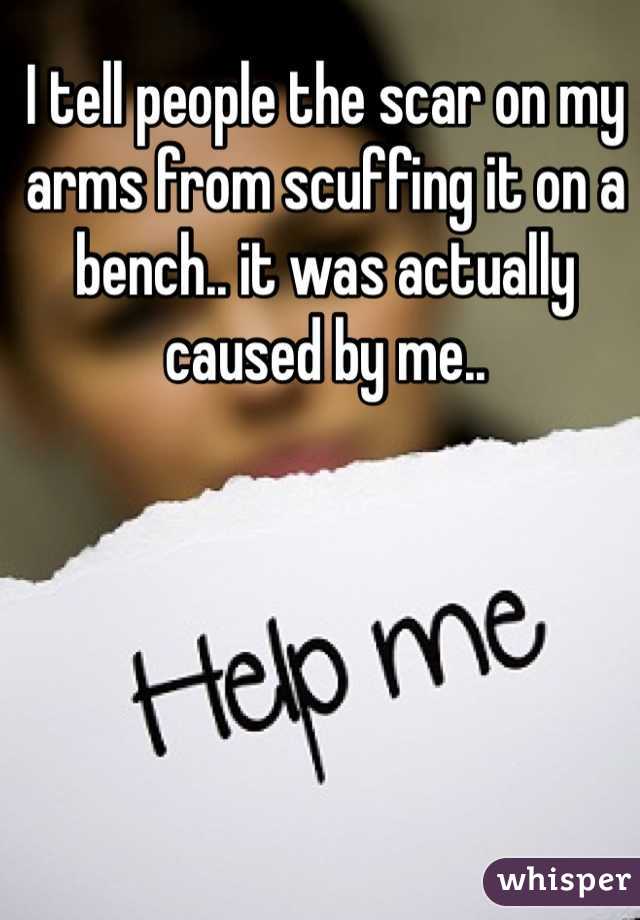 I tell people the scar on my arms from scuffing it on a bench.. it was actually caused by me..