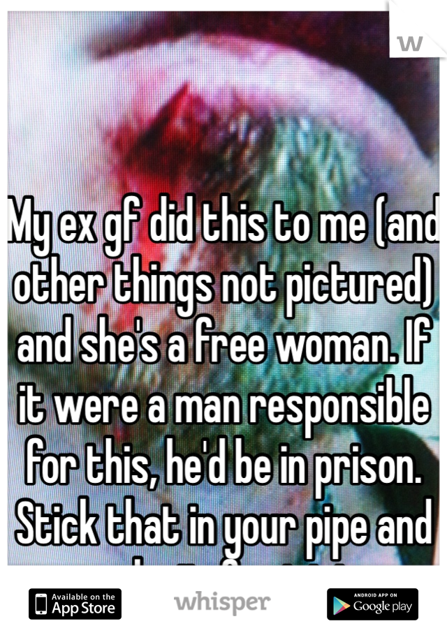 My ex gf did this to me (and other things not pictured) and she's a free woman. If it were a man responsible for this, he'd be in prison. Stick that in your pipe and smoke it, feminists. 