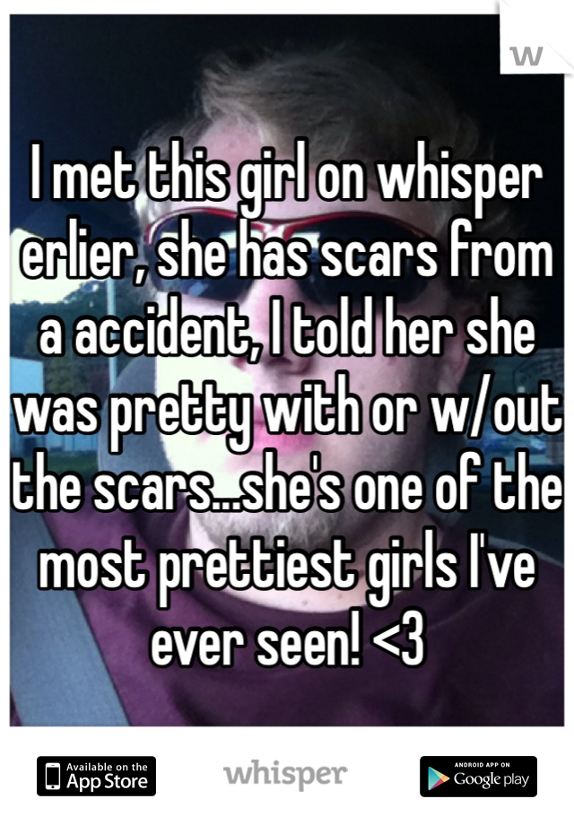 I met this girl on whisper erlier, she has scars from a accident, I told her she was pretty with or w/out the scars...she's one of the most prettiest girls I've ever seen! <3