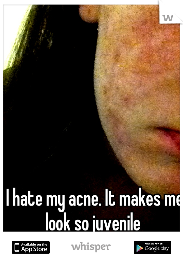 I hate my acne. It makes me look so juvenile 