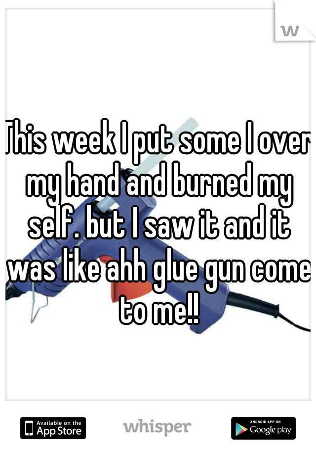 This week I put some I over my hand and burned my self. but I saw it and it was like ahh glue gun come to me!!
