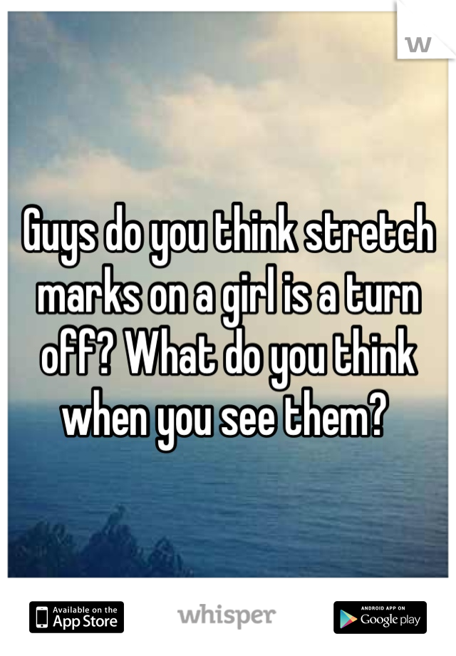 Guys do you think stretch marks on a girl is a turn off? What do you think when you see them? 