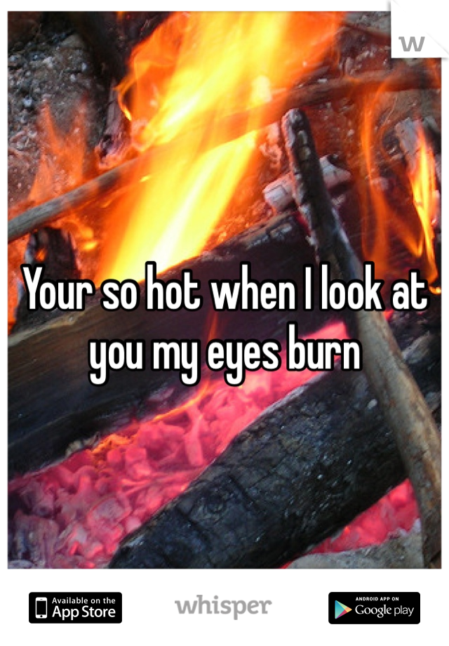 Your so hot when I look at you my eyes burn 
