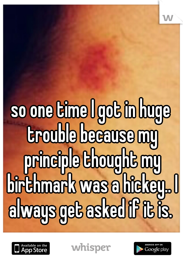 so one time I got in huge trouble because my principle thought my birthmark was a hickey.. I always get asked if it is. 
