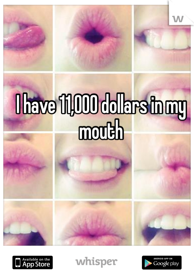 I have 11,000 dollars in my mouth
