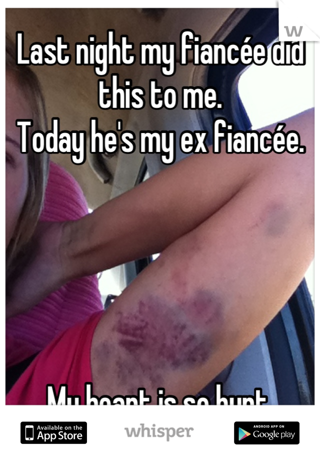 Last night my fiancée did this to me.
Today he's my ex fiancée.





My heart is so hurt.