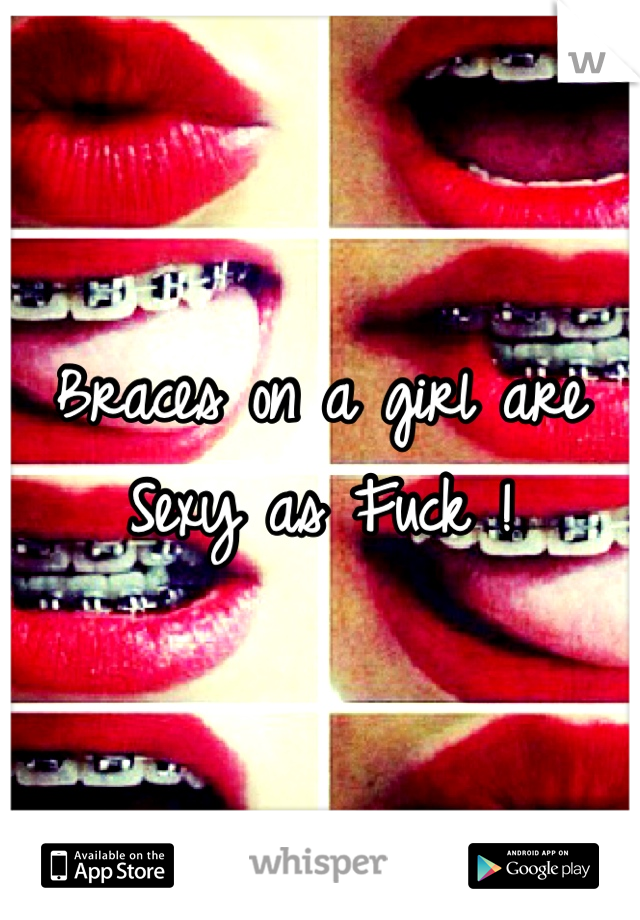 Braces on a girl are Sexy as Fuck !