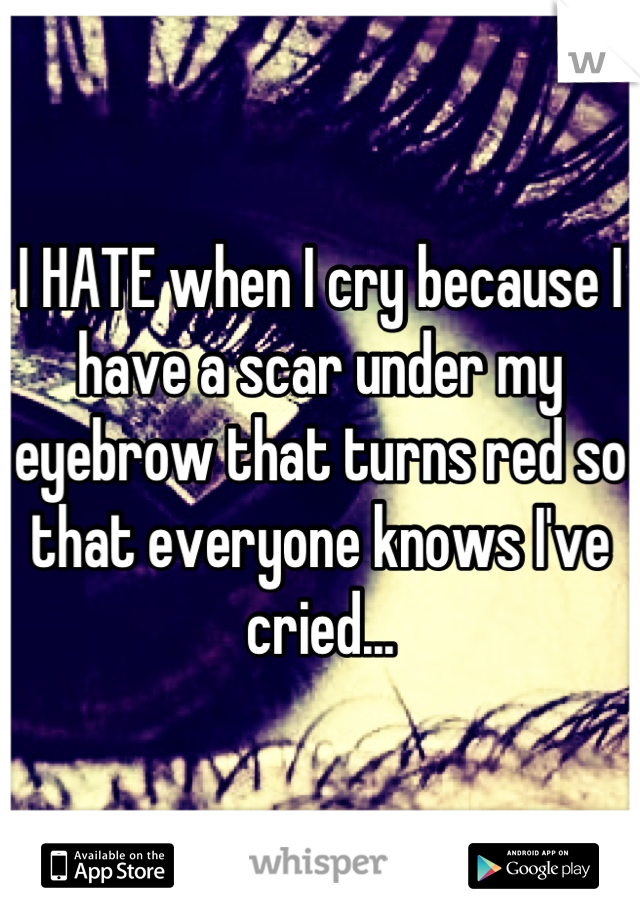 I HATE when I cry because I have a scar under my eyebrow that turns red so that everyone knows I've cried...