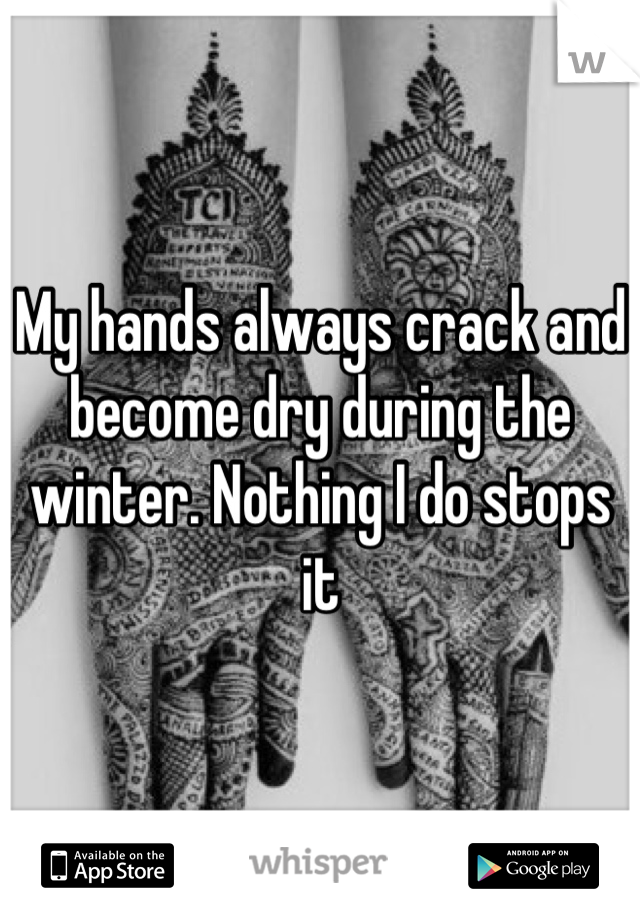 My hands always crack and become dry during the winter. Nothing I do stops it