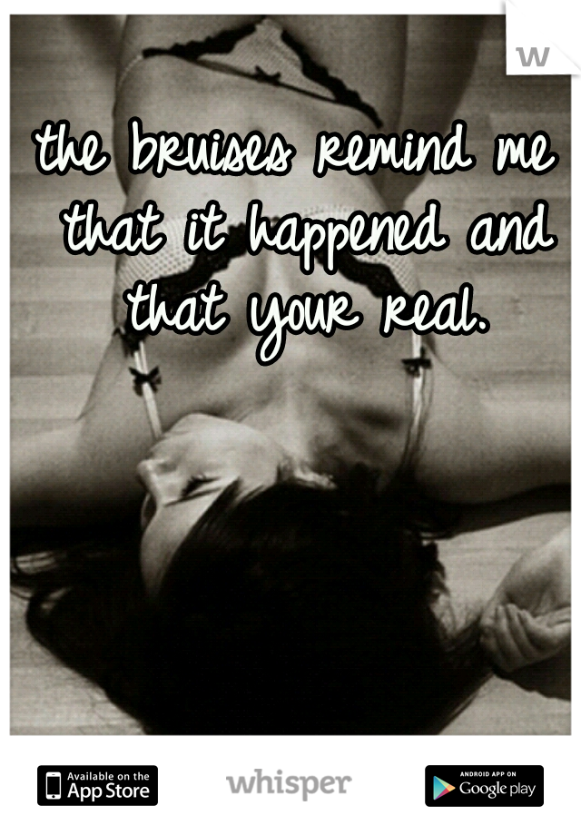 the bruises remind me that it happened and that your real.