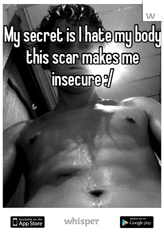 My secret is I hate my body this scar makes me insecure :/ 