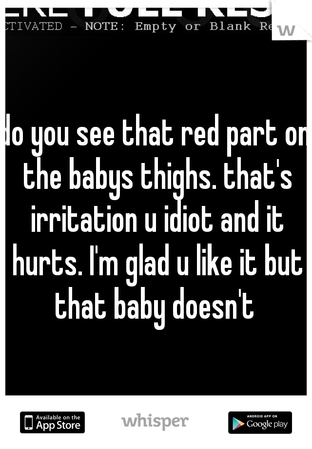 do you see that red part on the babys thighs. that's irritation u idiot and it hurts. I'm glad u like it but that baby doesn't 