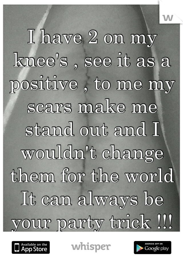 I have 2 on my knee's , see it as a positive , to me my scars make me stand out and I wouldn't change them for the world 
It can always be your party trick !!!