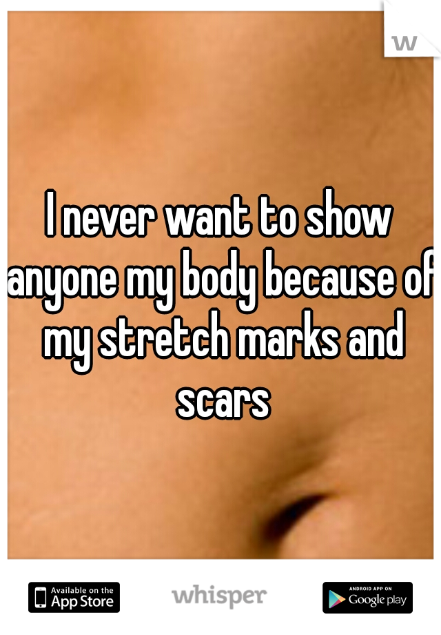 I never want to show anyone my body because of my stretch marks and scars
