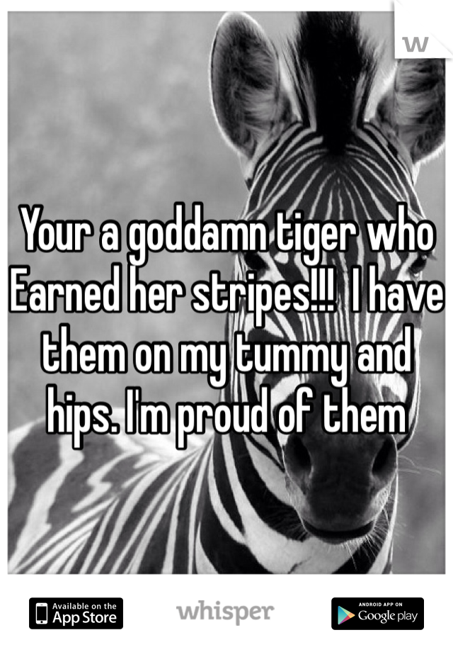 Your a goddamn tiger who Earned her stripes!!!  I have them on my tummy and hips. I'm proud of them