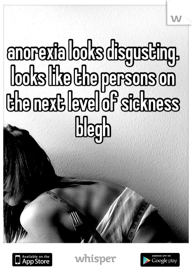anorexia looks disgusting. looks like the persons on the next level of sickness 
blegh