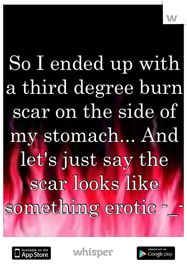 So I ended up with a third degree burn scar on the side of my stomach... And let's just say the scar looks like something erotic -_-