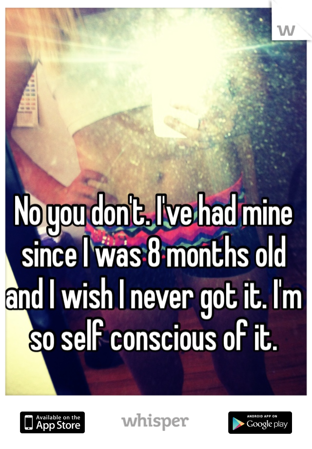 No you don't. I've had mine since I was 8 months old and I wish I never got it. I'm so self conscious of it.