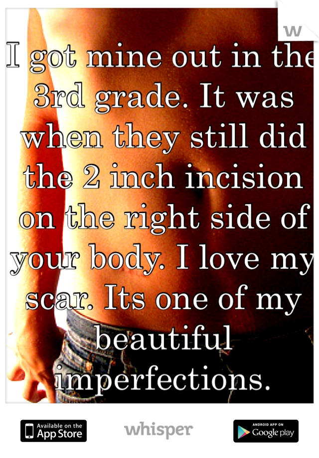 I got mine out in the 3rd grade. It was when they still did the 2 inch incision on the right side of your body. I love my scar. Its one of my beautiful imperfections.
