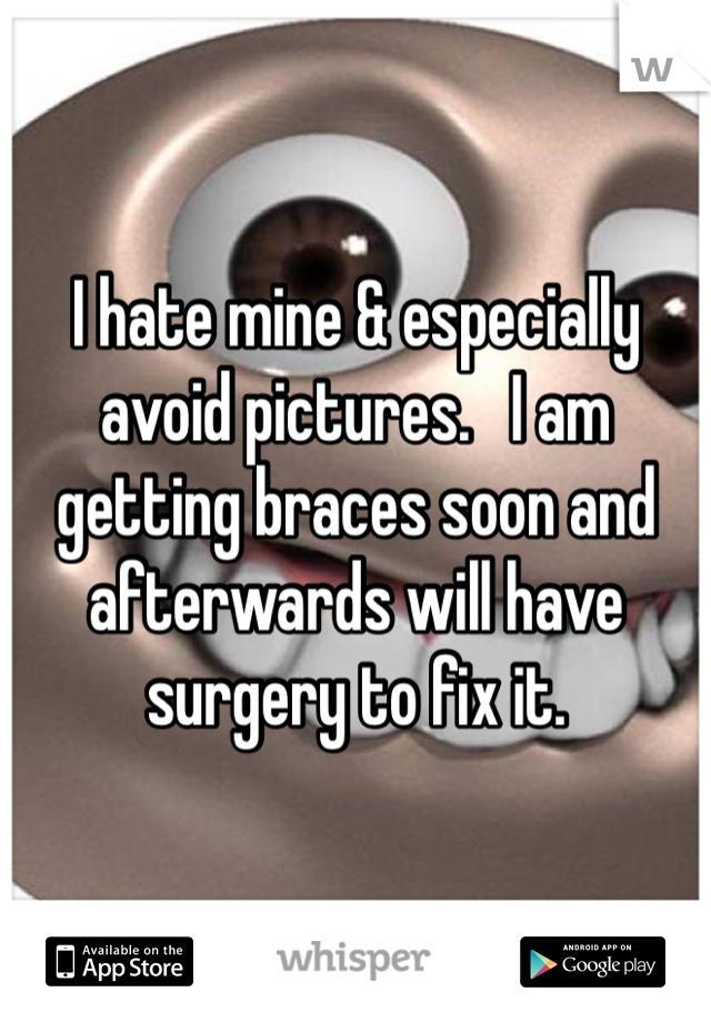 I hate mine & especially avoid pictures.   I am getting braces soon and afterwards will have surgery to fix it. 