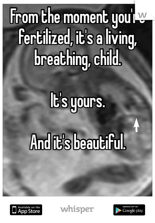 From the moment you're fertilized, it's a living, breathing, child.
 
It's yours.

And it's beautiful.