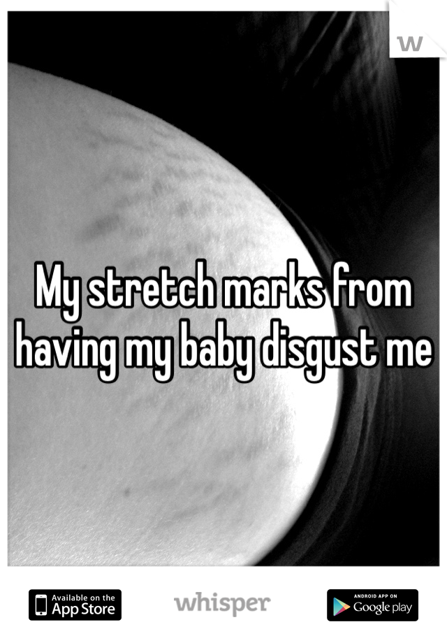 My stretch marks from having my baby disgust me 