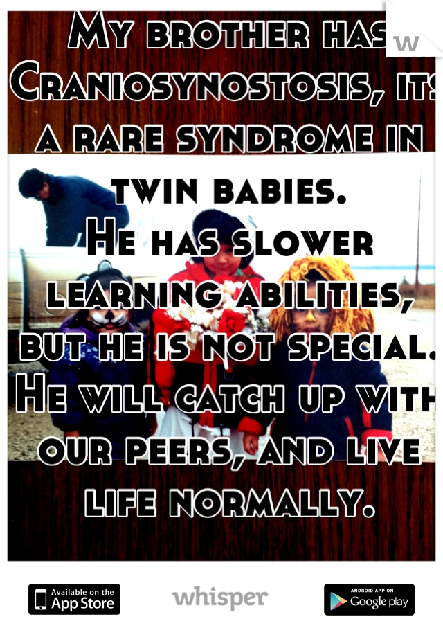 My brother has Craniosynostosis, its a rare syndrome in twin babies. 
He has slower learning abilities, but he is not special. He will catch up with our peers, and live life normally.

You're dumb.