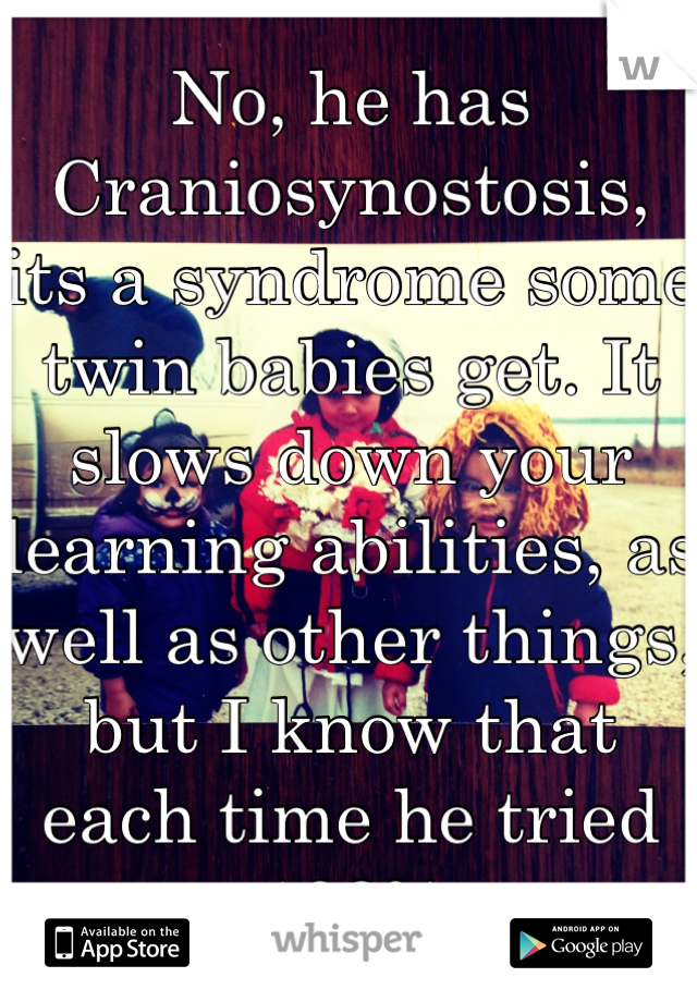 No, he has Craniosynostosis, its a syndrome some twin babies get. It slows down your learning abilities, as well as other things, but I know that each time he tried 100%