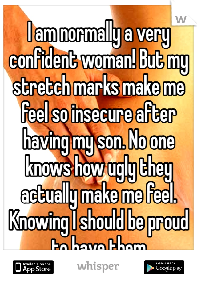 I am normally a very confident woman! But my stretch marks make me feel so insecure after having my son. No one knows how ugly they actually make me feel. Knowing I should be proud to have them 