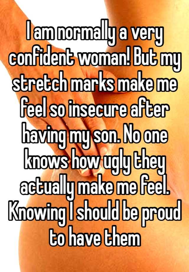 I am normally a very confident woman! But my stretch marks make me feel so insecure after having my son. No one knows how ugly they actually make me feel. Knowing I should be proud to have them 