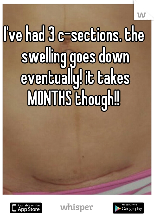 I've had 3 c-sections. the swelling goes down eventually! it takes MONTHS though!! 