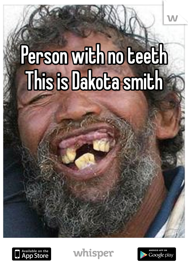 Person with no teeth
This is Dakota smith