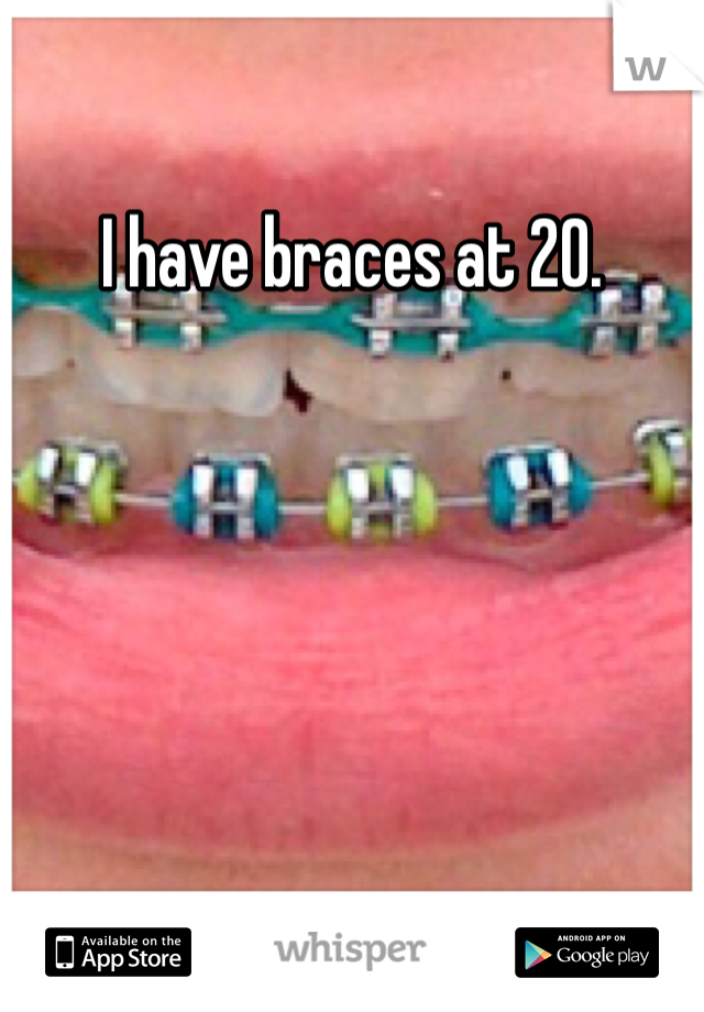 I have braces at 20.