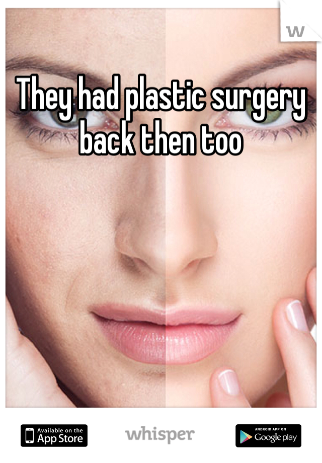 They had plastic surgery back then too