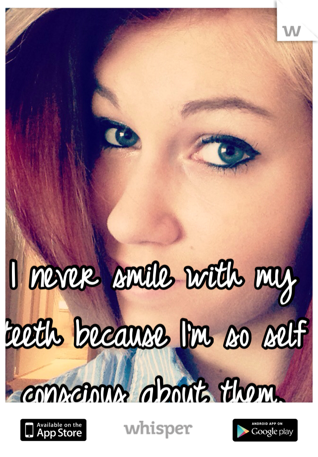 I never smile with my teeth because I'm so self conscious about them. 