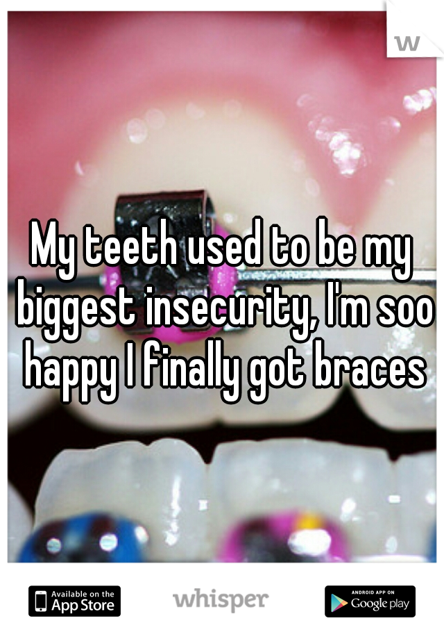 My teeth used to be my biggest insecurity, I'm soo happy I finally got braces