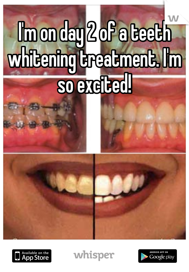 I'm on day 2 of a teeth whitening treatment. I'm so excited! 