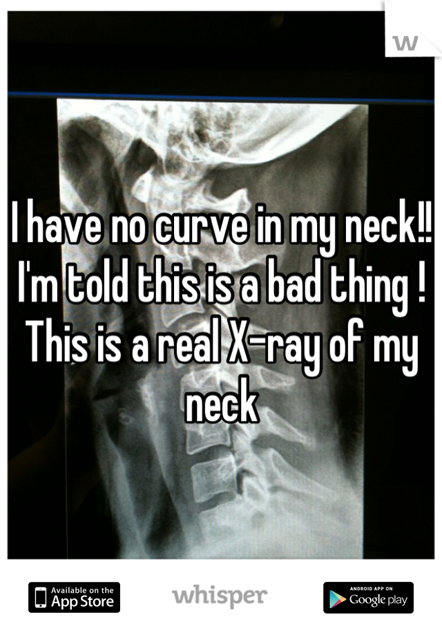 I have no curve in my neck!!  I'm told this is a bad thing !  This is a real X-ray of my neck