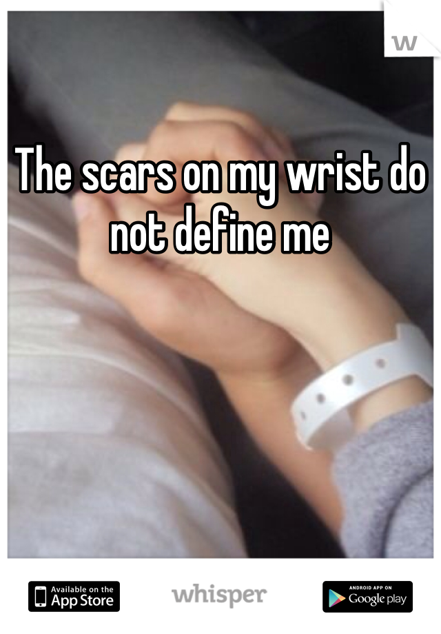 The scars on my wrist do not define me