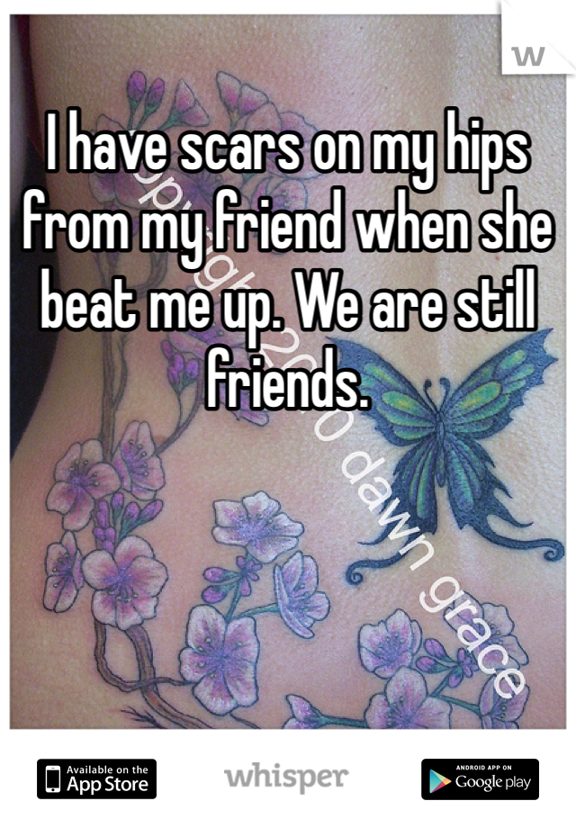 I have scars on my hips from my friend when she beat me up. We are still friends.