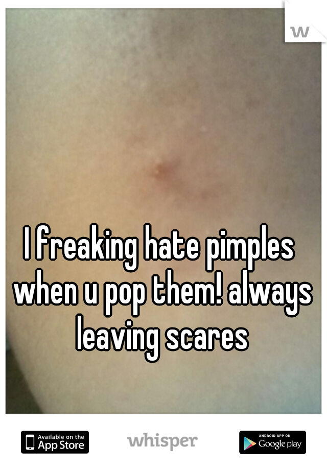 I freaking hate pimples when u pop them! always leaving scares