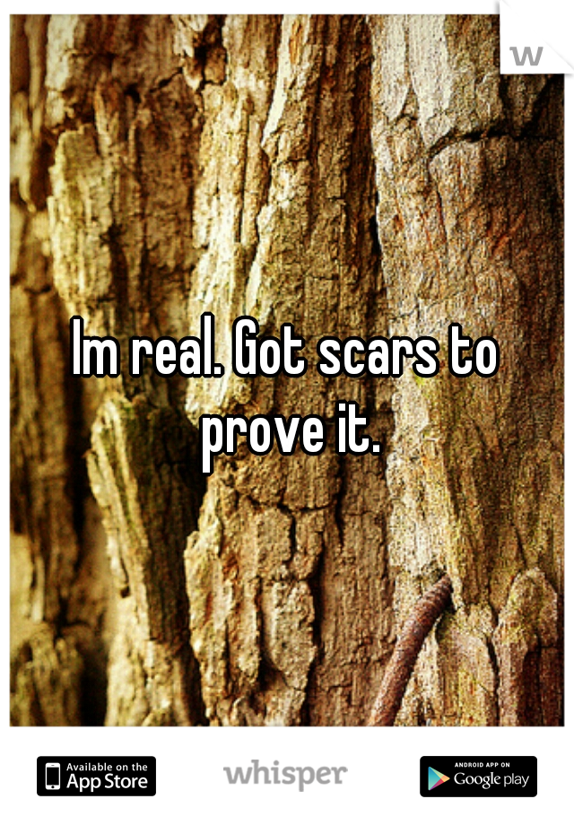 Im real. Got scars to prove it.