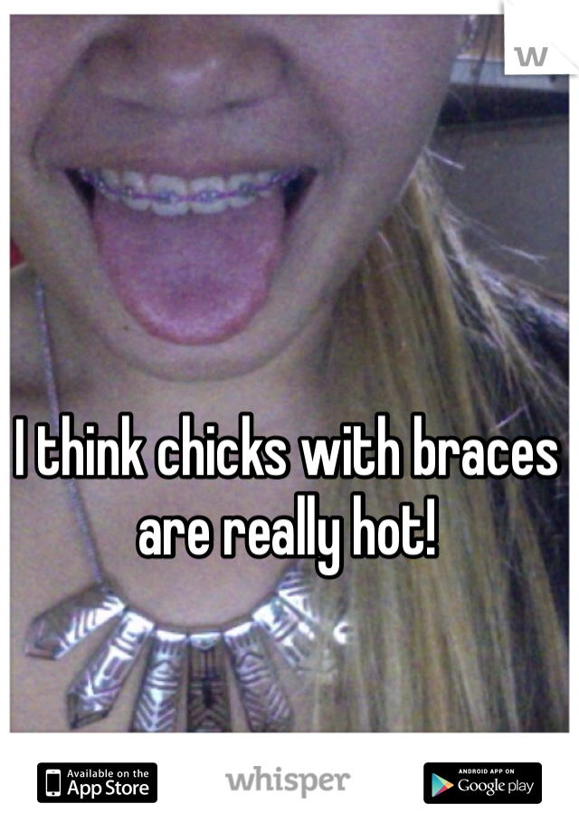 I think chicks with braces are really hot!