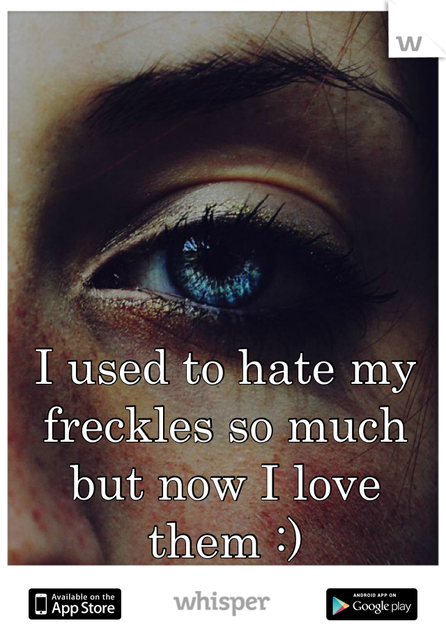 I used to hate my freckles so much but now I love them :)