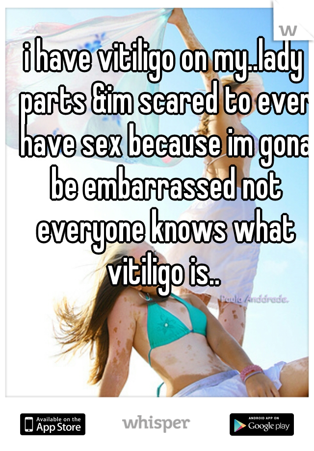 i have vitiligo on my..lady parts &im scared to ever have sex because im gona be embarrassed not everyone knows what vitiligo is.. 