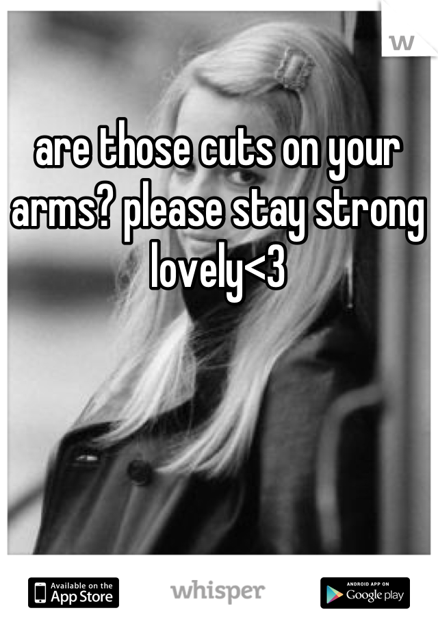 are those cuts on your arms? please stay strong lovely<3