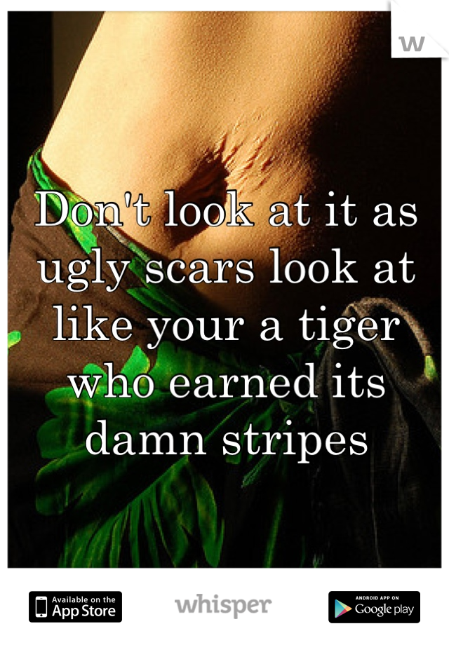 Don't look at it as ugly scars look at like your a tiger who earned its damn stripes