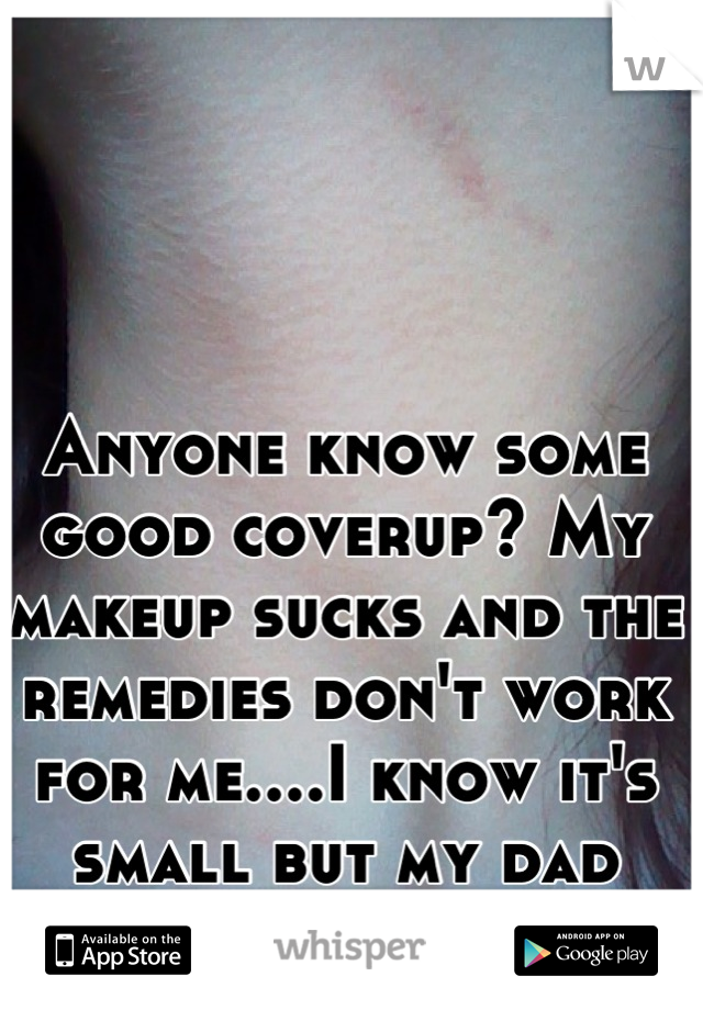 Anyone know some good coverup? My makeup sucks and the remedies don't work for me....I know it's small but my dad hates hickies. 