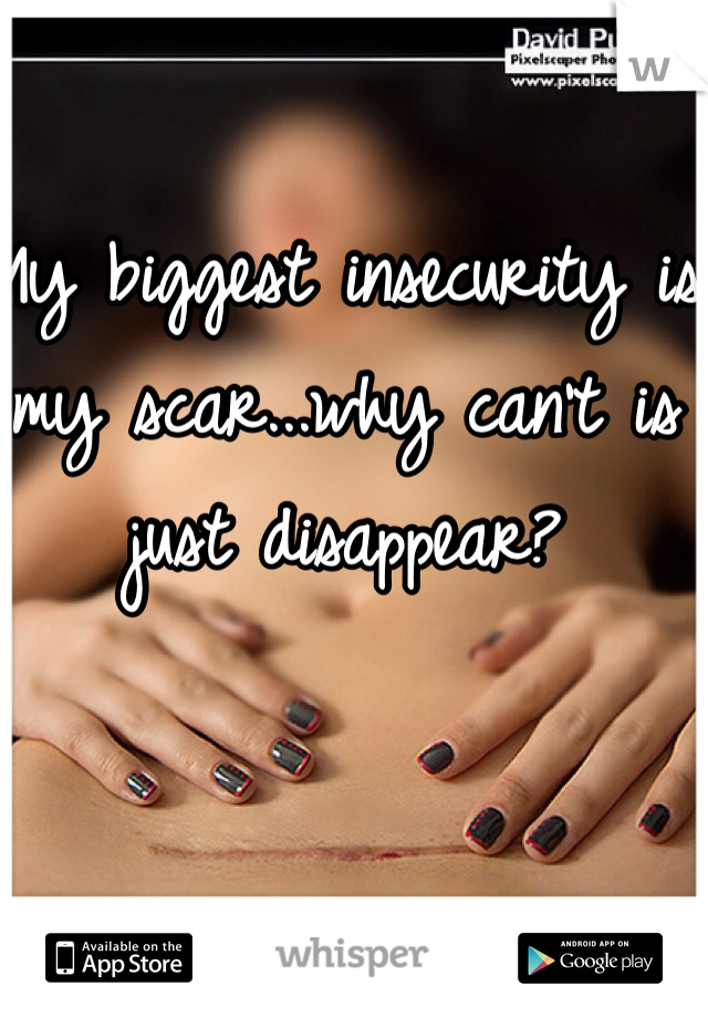 My biggest insecurity is my scar...why can't is just disappear? 